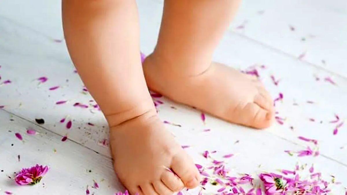 راه درمان پای پرانتزی کودکان | کمبود این ویتامین پا را پرانتزی می‌ کند!