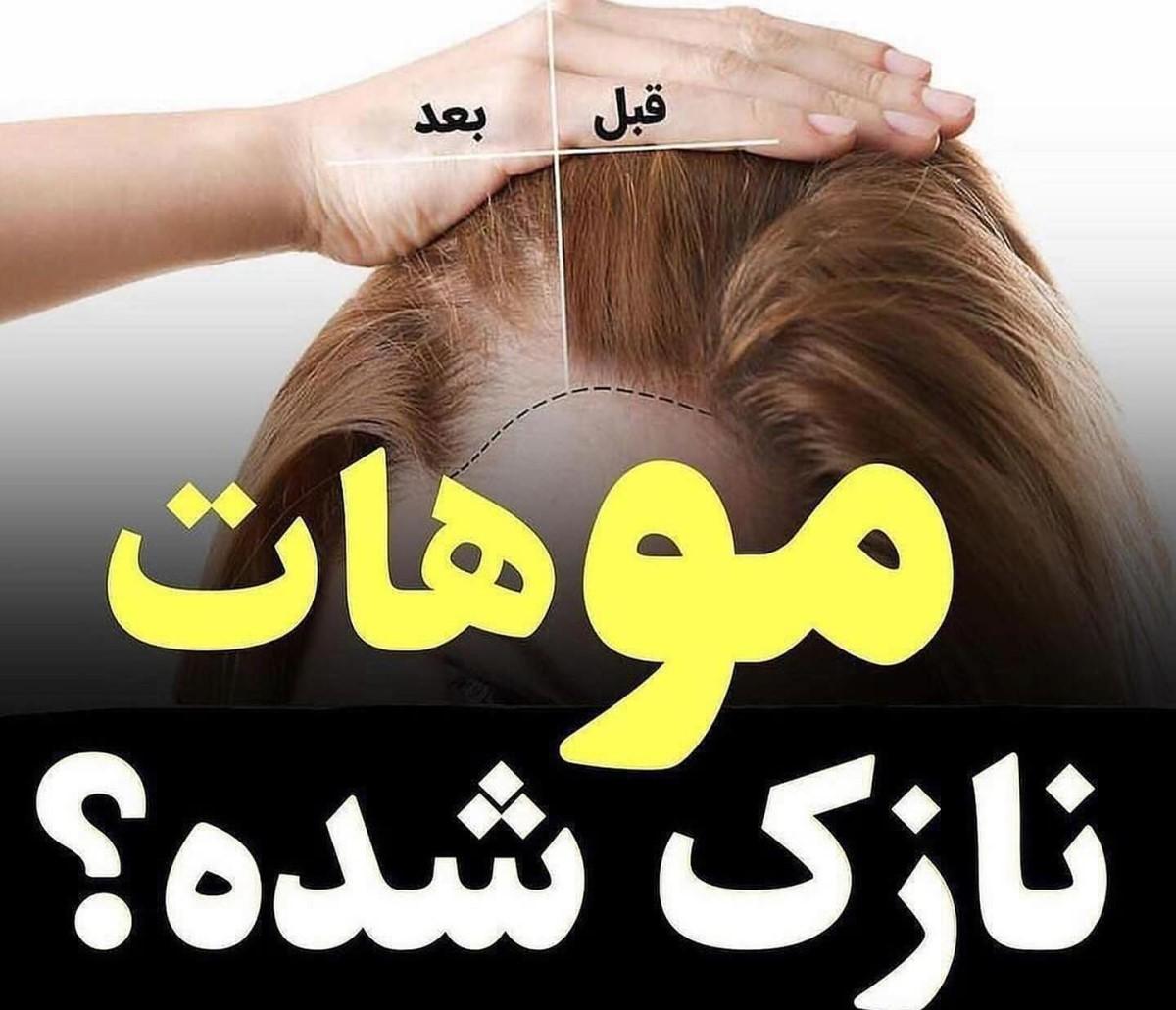 ۴ درمان خانگی موهای نازک شده | ۲ ماسک گیاهی پرپشت و ضخیم کننده موهای نازک در طب سنتی