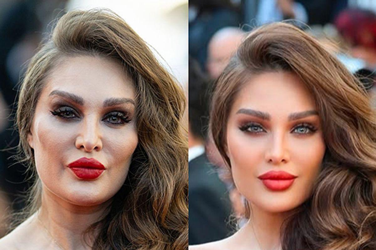 زیبایی جعلی طلا گلزار در سواحل شهر کن دفن شد