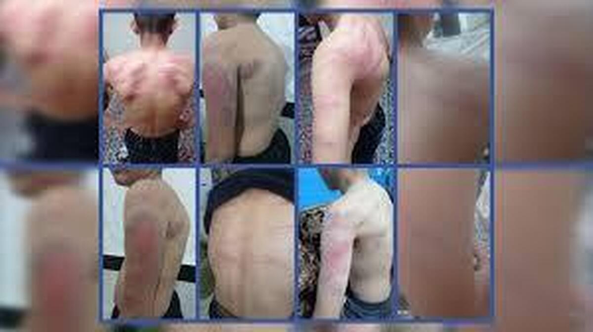 شکنجه‌ 13 دانش‌ آموز سنندجی توسط معلم به ‌دلیل گم‌شدن شارژر