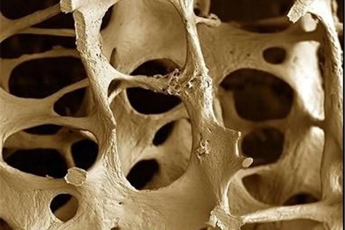 بهترین ویتامین‌ها برای تقویت استخوان‌ کدامند؟