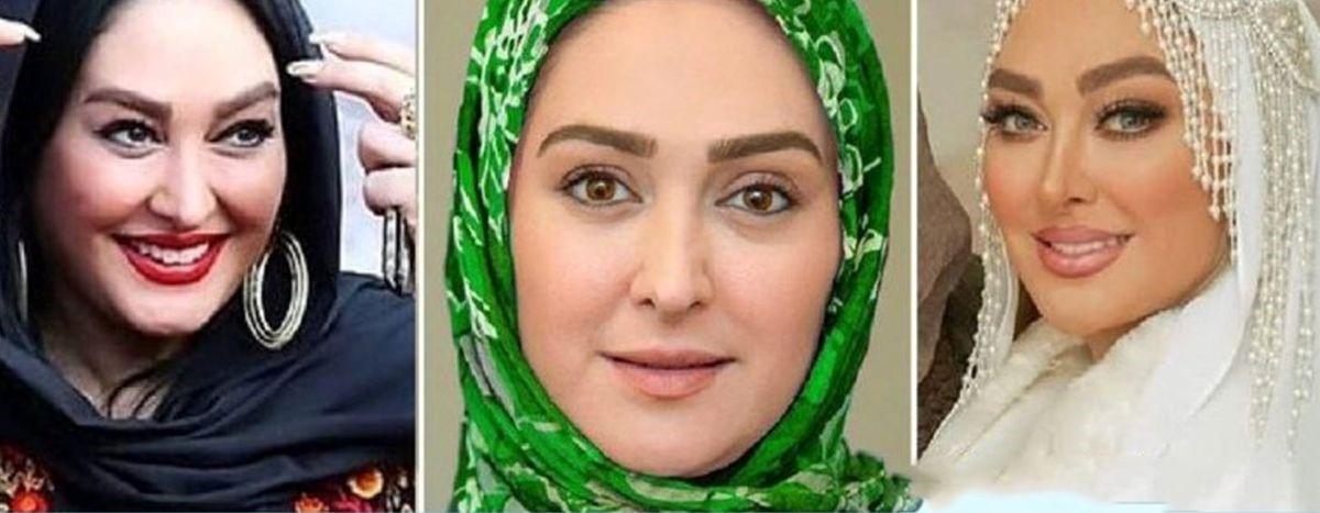 این بازیگران زن ایرانی بیشترین تغییر چهره را بعد از معروف شدن داشتند+عکس