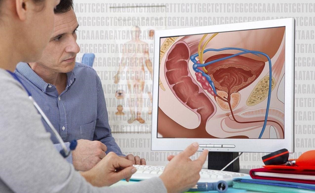 شایع ترین علائم بزرگی پروستات| خطرات بزرگ شدن پروستات| راه تشخیص بزرگی خوشخیم پروستات